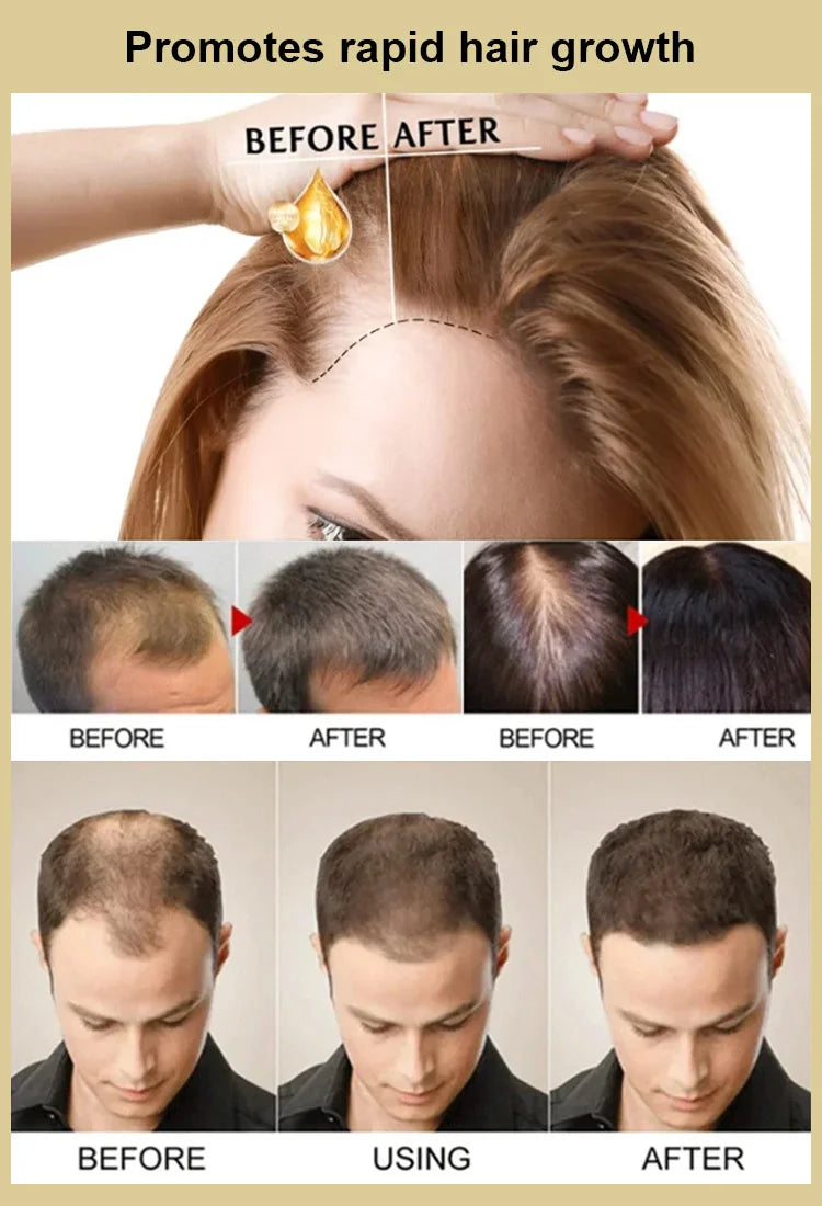 Natural Rosemary Hair Growth Essential Oil Welcome to our store. 100% Authenticity Guaranteed! Now flash sale - Get Me Products