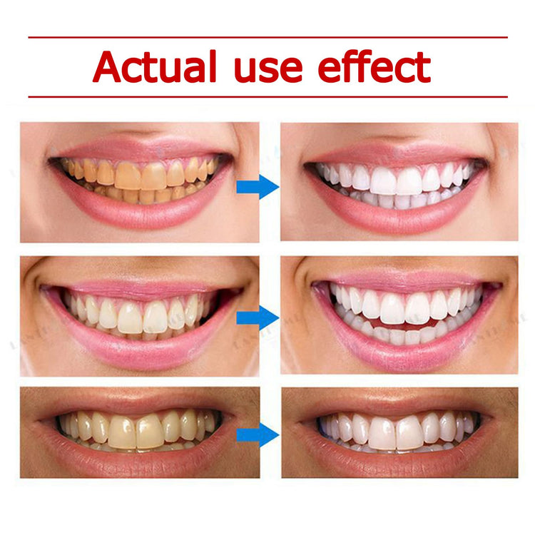 SP-6 Ultra Whitening Toothpaste 120g, Probiotics Toothpaste Sp-6 Brightening, Sp6 Teeth Whitening Toothpaste,Deep Cleaning&Fresh Breath Oral Care - Get Me Products