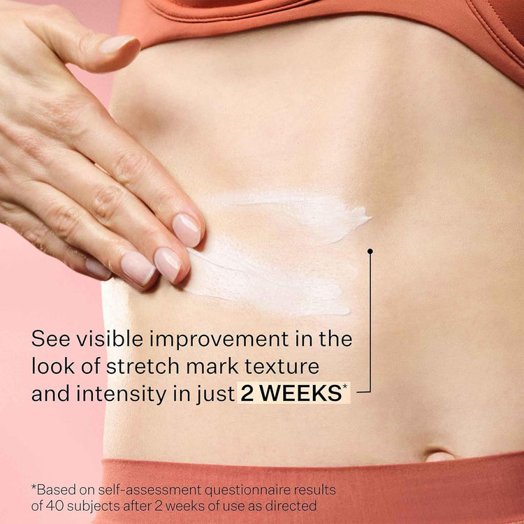 SD Advanced™ plus Intensive Moisturizer for Wrinkles & Stretchmarks, for Face & Body, Collagen Boosting with Peptides & Hyaluronic Acid