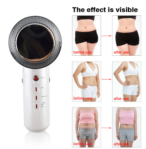 Beauty Care Slimming Device Handheld Ultrasound Body Fat Remove Massager - Get Me Products