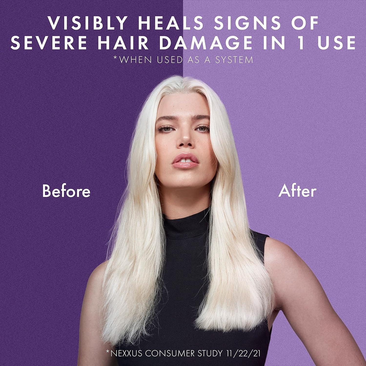 Keraphix Conditioner, for Damaged Hair, 33.8 Ounce