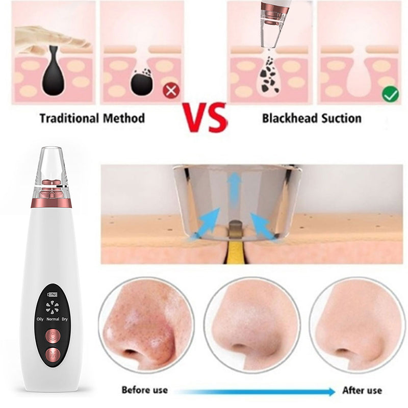 Blackhead Remover Pore Vacuum Cleaner - Upgraded Blackhead Suction Tool With Display-USB Rechargeable Facial Pore Cleanser 6 Replaceable Suction Probes For All Skin - Get Me Products