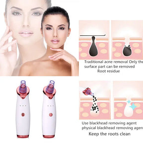 Blackhead Remover Instrument Black Dot Remover Acne Vacuum Suction Face Clean Black Head Pore Cleaning Beauty Skin Care Tool - Get Me Products