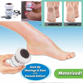 Electric Vacuum Foot Grinder File Machine Exfoliate Dead Skin Callus Remover Heel Removal Scraper Vacuums Grinding Head heel - Get Me Products