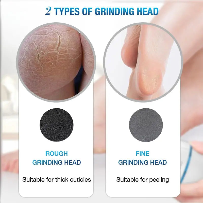 Electric Vacuum Foot Grinder File Machine Exfoliate Dead Skin Callus Remover Heel Removal Scraper Vacuums Grinding Head heel - Get Me Products