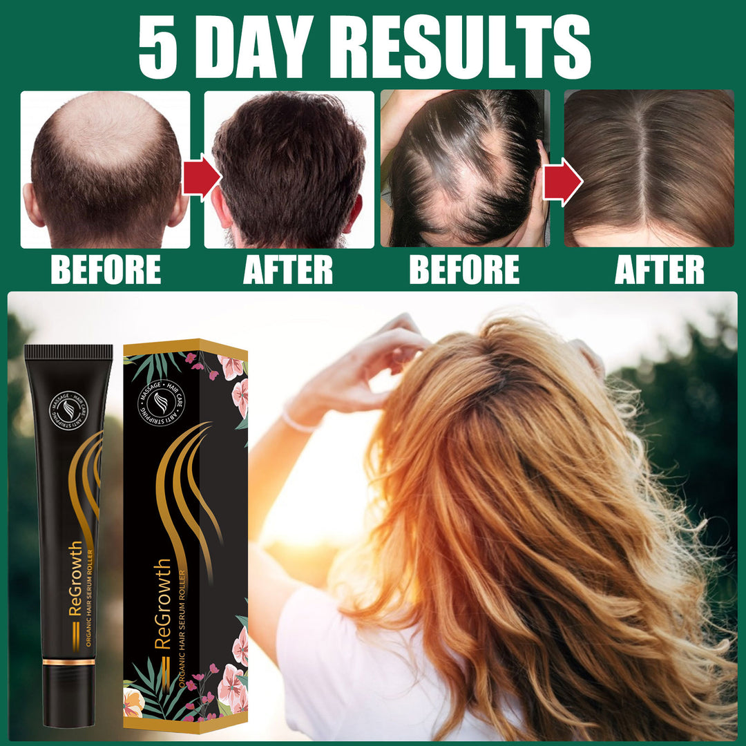 Regrowth Organic Hair Serum Roller Set Hair Care Anti Stripping Liquid Suitable For All Types Of Hair Loss Scalp Nourishing - Get Me Products